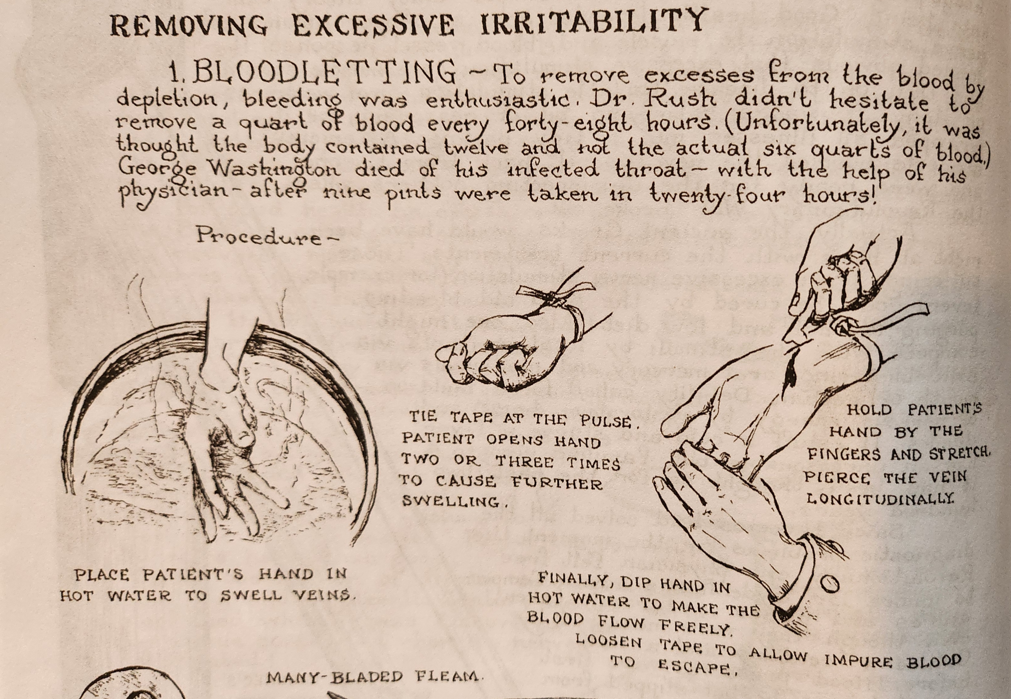 Vertigo in the Regency